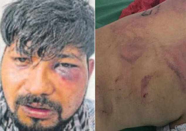 देहरादून में स्कूटर की टक्कर के बाद हैवानियत, युवक को बंधक बनाकर दी अमानवीय यातनाएं